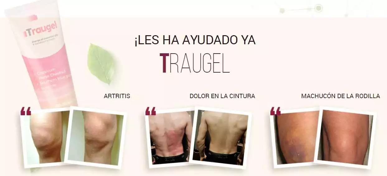 Compra Traugel en una farmacia de Pamplona – ¡Alivia tu dolor muscular!